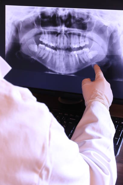 Best Emergency Wisdom Teeth Removal in Oak Grove, TN